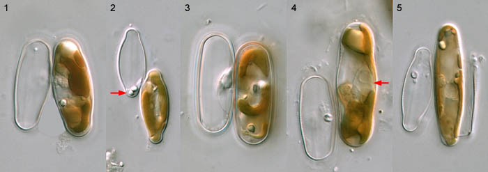 Sellaphora: zygotes and auxospores