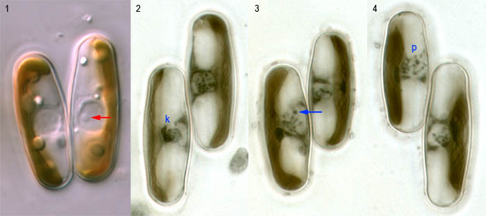 Sellaphora blackfordensis: meiotic prophase